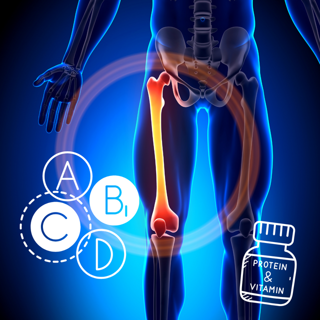Medical illustration of a hip and leg bone with vitamin A, B, C and D icons