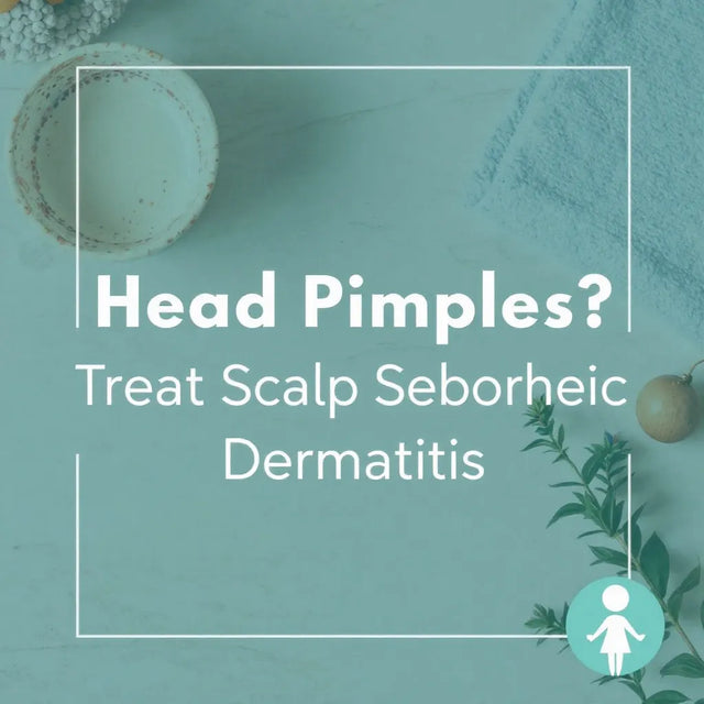 Graphic about treating scalp seborrhoeic dermatitis on a pale green background
