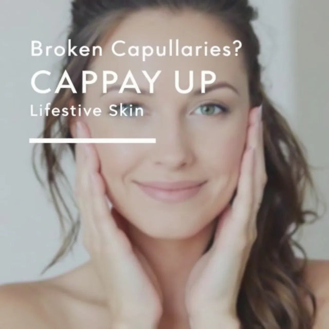 Graphic about broken capillaries and sensitive skin beside a smiling woman