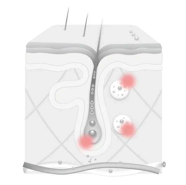 Impact illustration 2